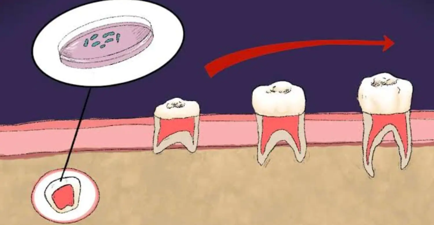 Regrowing Teeth 2